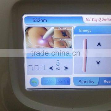 500w High PowerLaser Tattoo Removal System Tattoo Removal Laser Medical CE photo-2