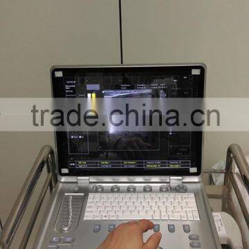 C7 KONTED 3D Portable Color Doppler Ultrasound Machine photo-2