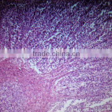 Human oral pathology slides,pathology prepared slides