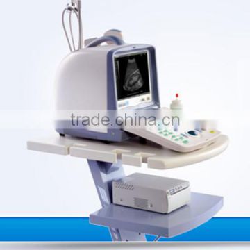 Portable laptop ultrasound scanner/Ultrasound diagnostic machine