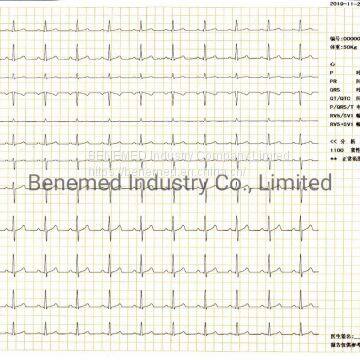 Hotsale Cheap Digital Hospital Electrocardiograph 12 Channel ECG Machine photo-5