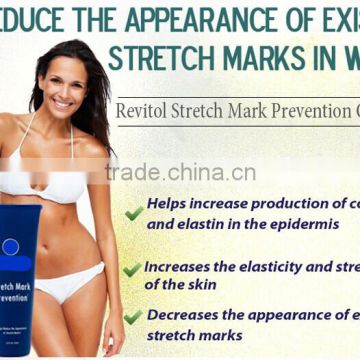 Anti stretch mark removal cream