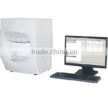 computer visual field analyzer eye perimeter