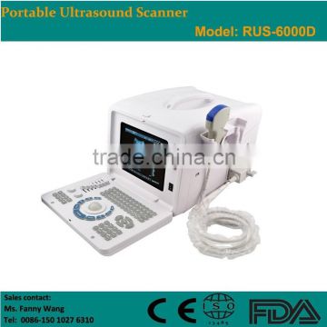 CE approved Portable B-Mode Ultrasonic/ Ultrasound Scanner with 3.5Mhz multi-frequency convex probe RUS-6000D