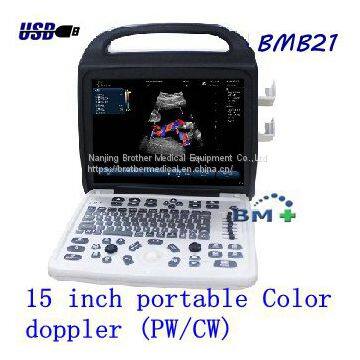 15 inch portable Color Doppler Ultrasound Scanner (PW/CW)