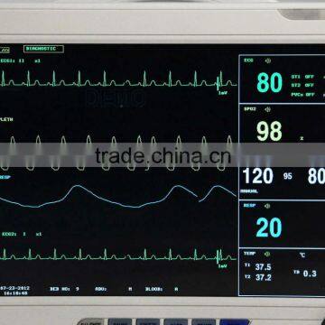 CE Approved 6 Parameter Multifunction Patient Monitor Dual TEMP IBP ETCO2 Printer Trolley Optional photo-3