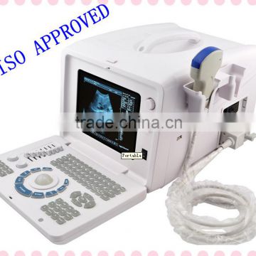 CE ISO certificate multi-frequency optional probe Ultrasound Scanner RUS 6000D exporter