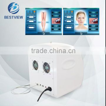 BESTVIEW Professional portable vascular therapy spider vein removal