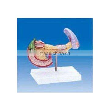 Spleen ,pancreas,gallbladder and duodenum pathological model