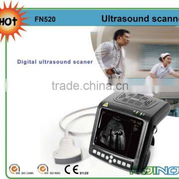 FN520 CE approved HOT selling portable palmsize ultrasound scanner