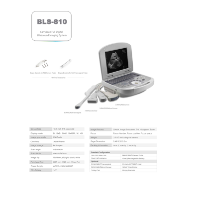 All Digital Ultrasonic Diagnosis SystemPortable Digital Acoustic Diagnostic Scanner for Human in Hospital photo-2