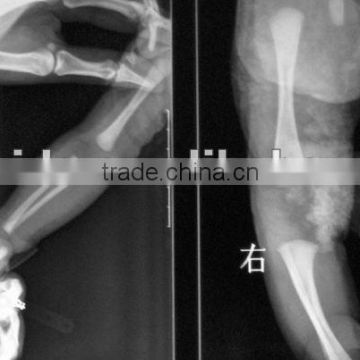 x-ray film and thermal film used in clinic and hospital