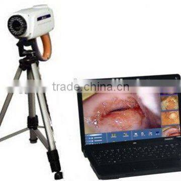 advanced digital electronic colposcope with new design