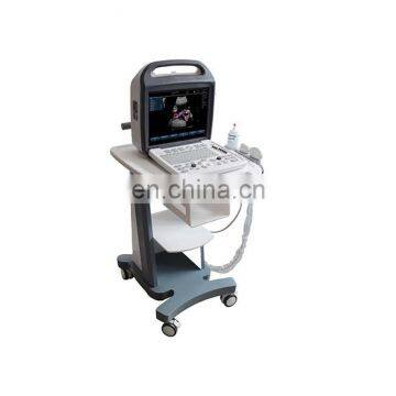 Medical Equipment Ultrasound System Portable Ultrasound Machine Scanner