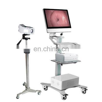 Microscope Gynaecology Female Colposcope Video Optical with Trolley