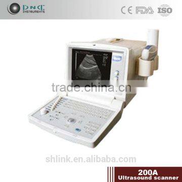 200A Hospital portable ultrasound scanner diagnostic system