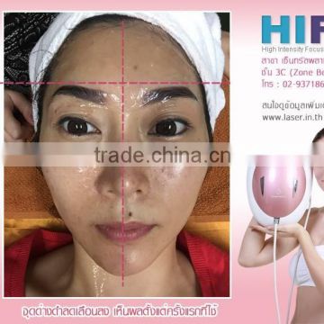 High Frequency Galvanic Machine Hifu Wrinkle Removal / Portable Hifu 0.2-3.0J Machine / Hifu For Wrinkle Removal System No Pain