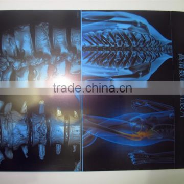 AGFA 5300 5302 DT2B X ray film medical x ray film x ray film china