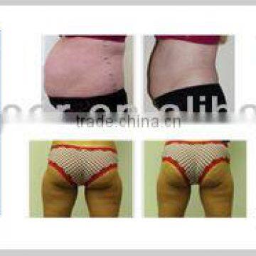 Portable Factory Price Advanced Ultrasound Sliming Machine photo-5