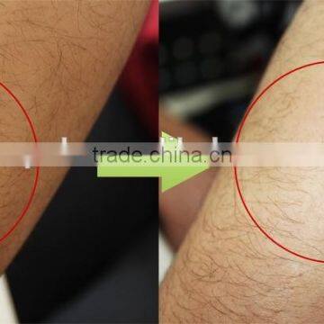 New Innovative Product Ideal Hair Removal Home Use IPL SHR/SHR(super Hair Removal) photo-5