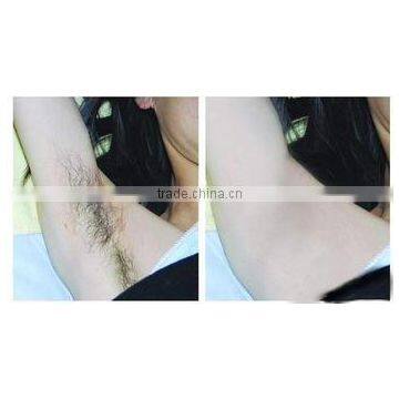 Most Effective Permanent 808nm Diode Laser Hair Removal Equipment With Factory Price photo-4