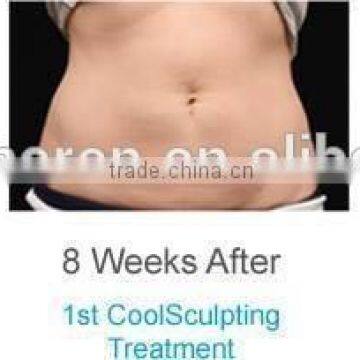 Cellulite Freezing Cool Shaping Body Massage Equipment for Weight Loss photo-4