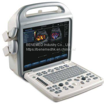 Popular Portable Color Doppler Ultrasound Scanner photo-2