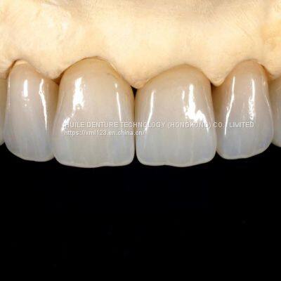 Crown & Bridge A Professional Outsourcing Dental Lab. photo-3