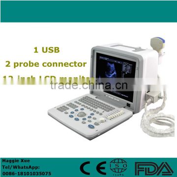 Digital LCD Portable Ultrasound Scanner USG medical machine manufacturer