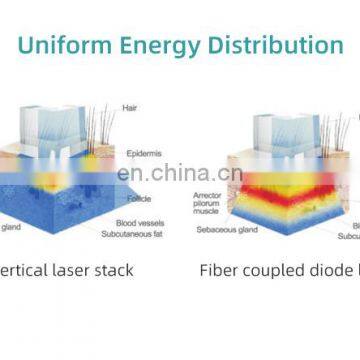 GSD 30W Fractional CO2 Laser Facial Beauty Machine Vaginal Tightening Facial Beauty Equipment photo-7