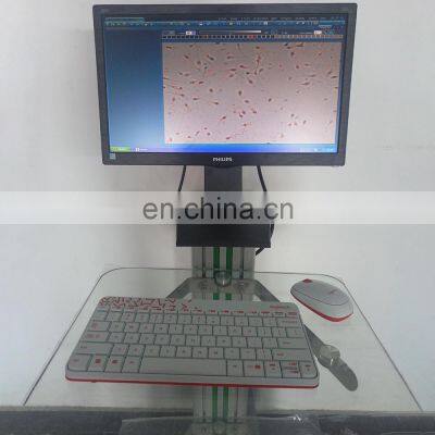 Advanced Factory Medical Sperm Quality Testing Analyzer Automatic Sperm Semen Analyzer Extractor photo-3