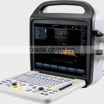 Factory SUPPLY Portablolor Ultrasound Machines/ultrasound Scanner CE Approval Doppler Ultrasound Scanner photo-3