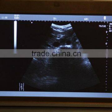 2016 Promotion Medical Portable Laptop Clinic Hospital Ultrasound Scanner Machine With 3.5Mhz Convex Probes--RUS-9000F-Shelly photo-5