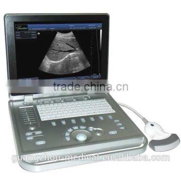 MCB-SS-9 Fully New CE Laptop Fully Digital Ultrasound Scanner