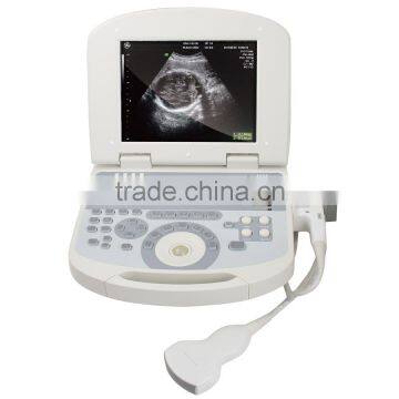 Hign Quality Ultrasound Machine With Low Price photo-2