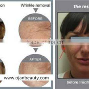 Professional Medical Led Light Therapy Omnilux Revive Beauty Machine photo-3