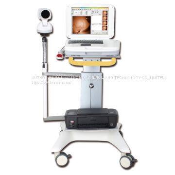 YKD-1003 Medical Infrared Breast Examination System