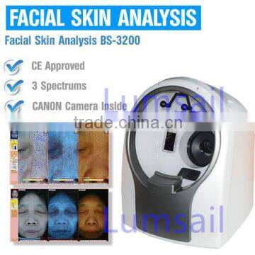 3D Skin Scanner Skin Problem Checking Machine