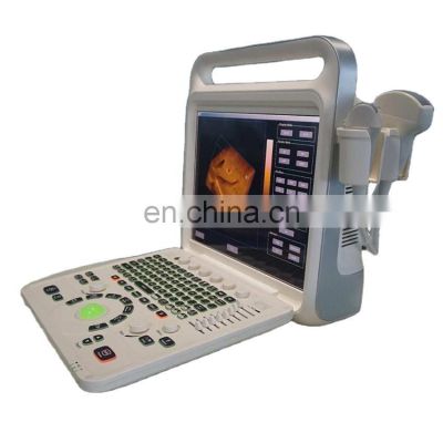 Portable Color Doppler Ultrasound System 15 inch 2d 3d 4d ultrasound Machine