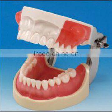 Incision/Pus Removal dental model