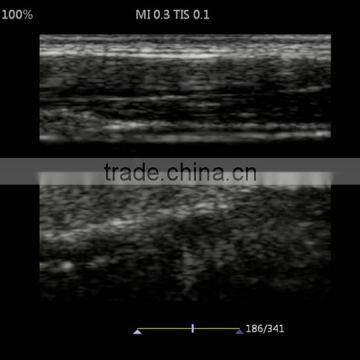 UProbe-20 Probe Type Ultrasound Scanner for Laptop photo-6