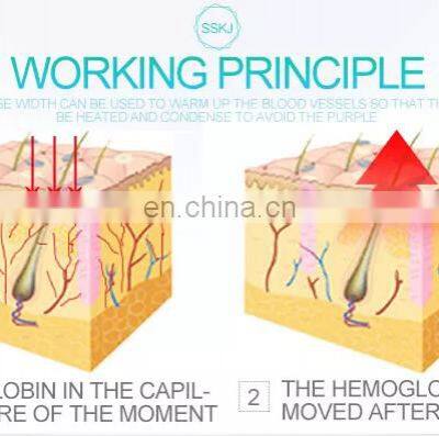 2020 Hot Sale With ODM OEM Diode Laser 980 nm Spider Vein Removal Machine photo-5