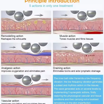 New Upgraded Inner Ball Roller Slim Endo Rollers Massaer Slimming Facial Lifting Body Shaping 8D Roller Beauty Machine photo-4