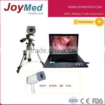 Digital Camera video colposcope for vagina money making machine