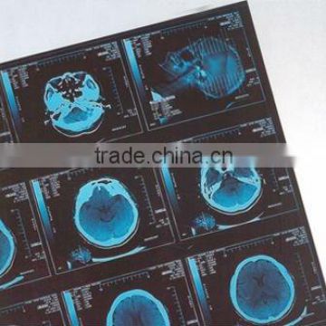 medical digital x ray film,digital x ray film,konica medical x ray film