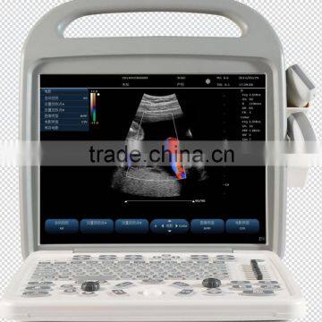 Factory SUPPLY Portablolor Ultrasound Machines/ultrasound Scanner CE Approval Doppler Ultrasound Scanner photo-2