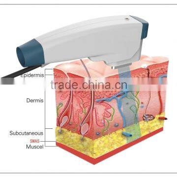 Newest Skin Tightening Face Lifting RF Machine photo-2