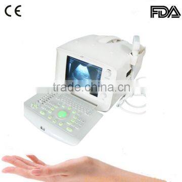 Low cheap FDA CE mark Portable Ultrasound Scanner with Convex linear transvaginal rectal probe optional