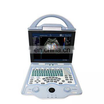 MY-A027A 2D Full digital color doppler system Portable ultrasound machine price