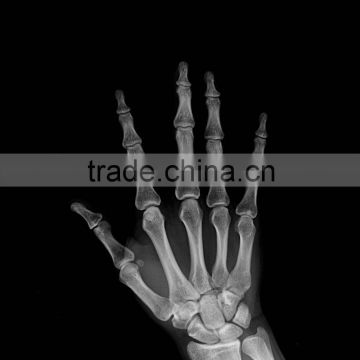 x-ray digitizer fuji, agfa x-ray film 14x17 of suppliers of hospital products